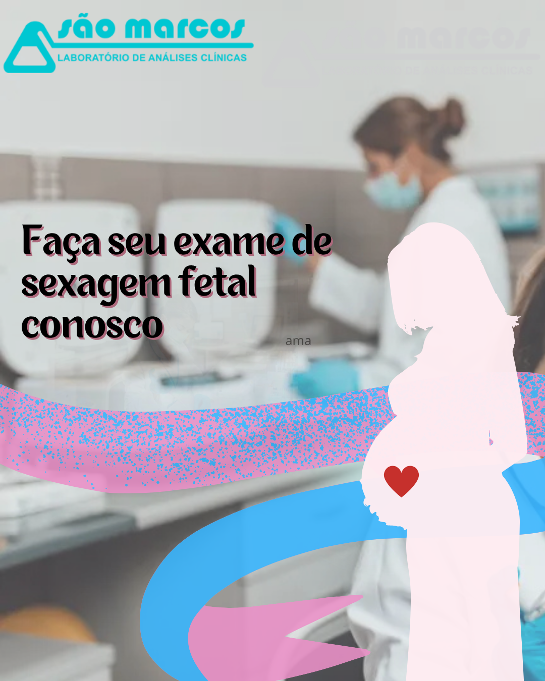 Criar story, post entre outros para divulgação de sua loja ou empresa 